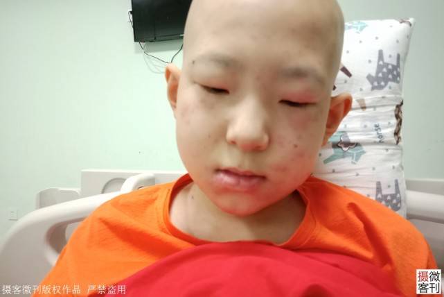 残疾|儿子10岁后却发现悲剧了湖北残疾理发哥娶娇妻幸福满满