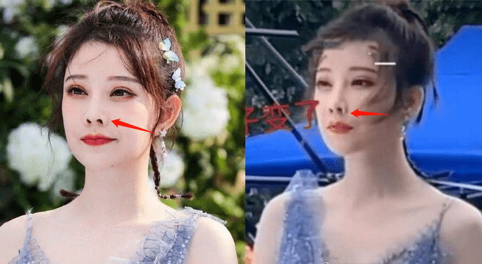 do|冯提莫这是后遗症出来了还是do了两次？搞成猪鼻子了…