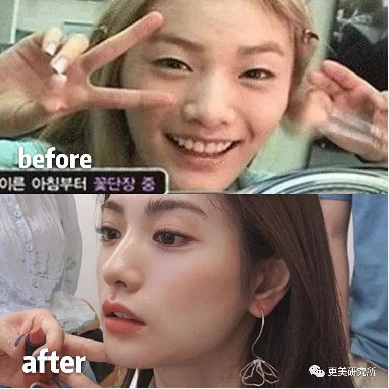 do|20年不崩的do圈C位,鞠婧祎baby都求她医生,堪称医学奇迹