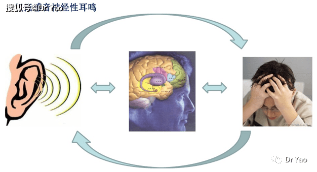 音乐治耳鸣是什么原理_耳鸣是什么原因引起的