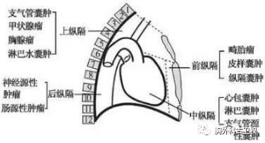 2,纵隔肿瘤有什么症状?