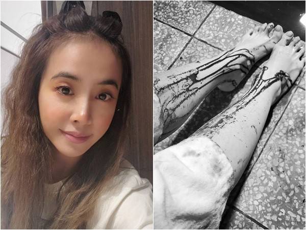 蔡依林晒“双腿流血照”超吓人 经纪人亲曝近况揭秘