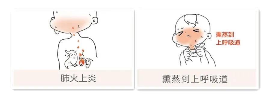 过敏性|孩子有流鼻涕咳嗽症状，警惕这个病！和感冒很类似秋季高发