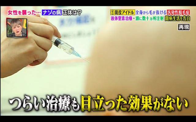 pippi|日本15岁患上“脱毛症”，却意外走上了新人生