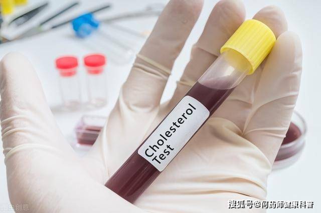 血脂怎么检测的 8f37666fddf34e9f9a7a29c5bb7f1a3a.jpeg