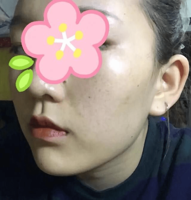 吃什么可以祛黄褐斑淡斑 1e91d534d56144e0a66bb5baba45bbcf.png