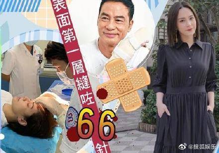 阿娇伤情新进展：缝合几百针靠冰敷和止痛药入