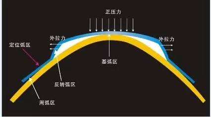 13岁孩子近视怎么办