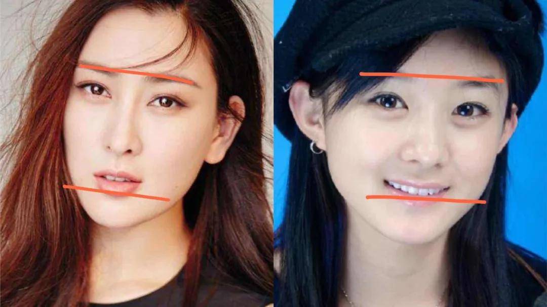 8分|3分到8分，为什么有人是天生适合整容脸?