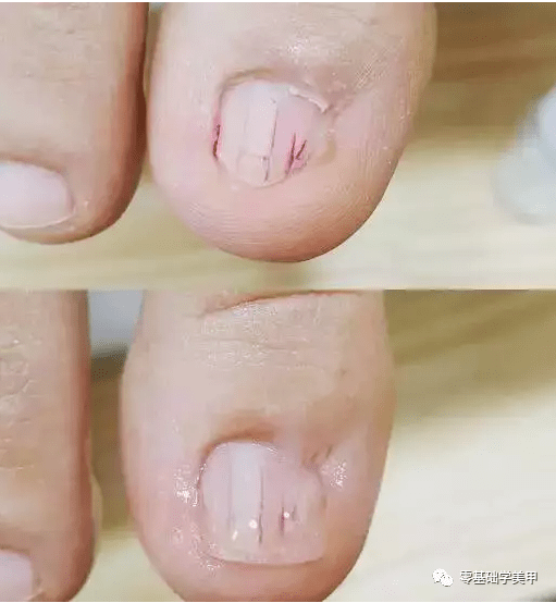 怎么能让指甲粘得更紧 899a67593f9647ad81a93da7432d0c22.png