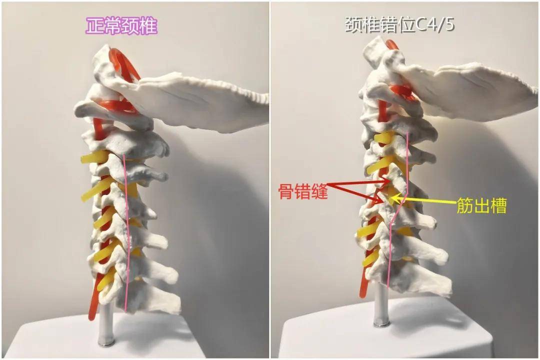 什么错骨成语_成语故事图片