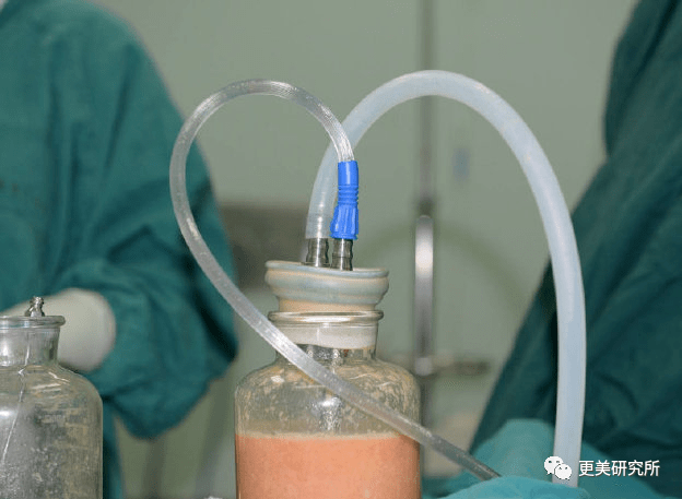 脂肪|鞠婧祎再花70w能do成迪丽热巴的前凸后翘？！