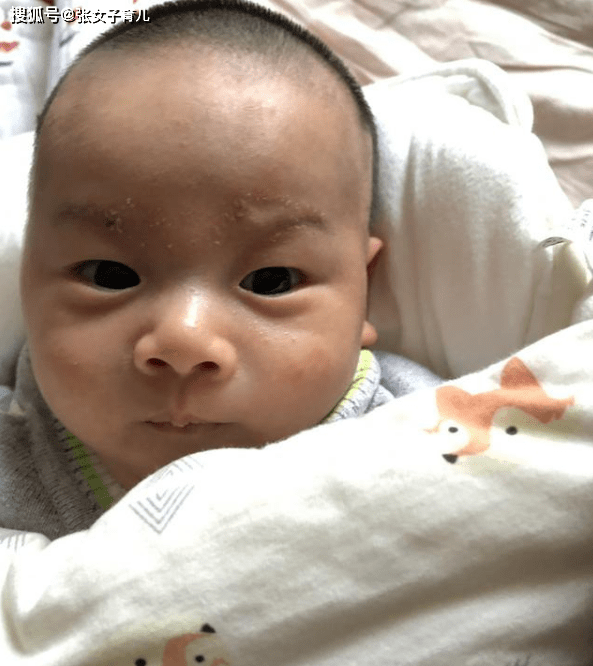 才是|9个都会长奶藓呢?没能对症下药,才是根本原因为什么10个宝宝