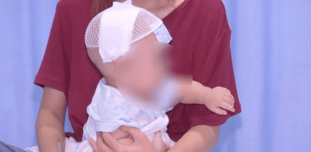 头型|医生一句话惊醒家长湖南发现多例！七个月大宝宝头型酷似外星人