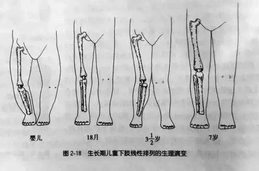 这4个错误做法,可能让宝宝骨骼"发育畸形",很多人被蒙在鼓里