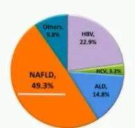 代谢相关脂肪性肝病是我国慢性肝病中发病率非常高的一种.