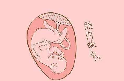 宝宝在肚子里缺氧怎么办