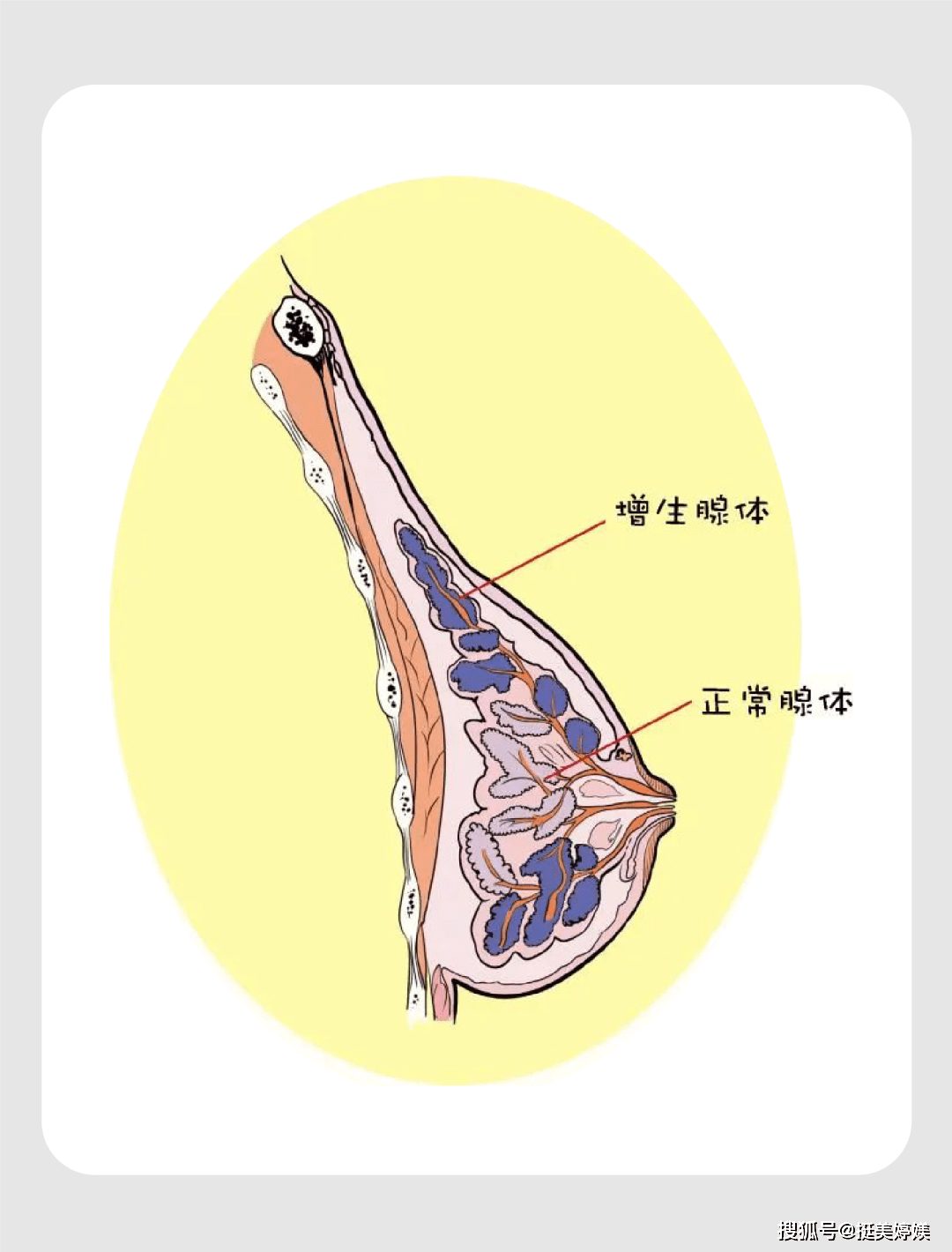 10个女人7个乳腺增生,乳益宝:这些胸部的秘密,80%的女性都不知道