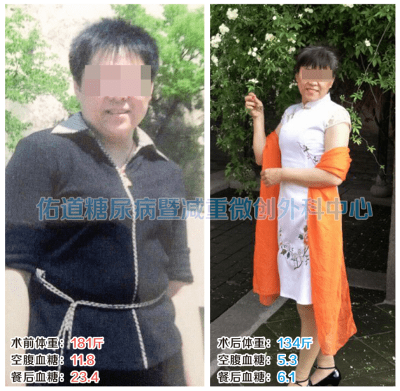 患者|作为女性的你该知道的糖尿病知识