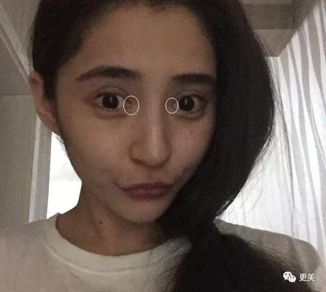 do|胖成球，眼睛do到快掉出眼眶，周杰伦最美“前女友”咋了...