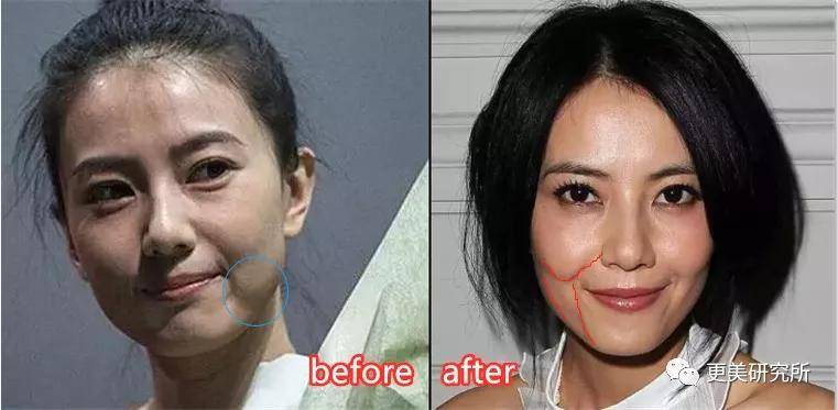 fa|今年最火的三字顶流这是要做鞠婧祎第二，换头动骨do全套？