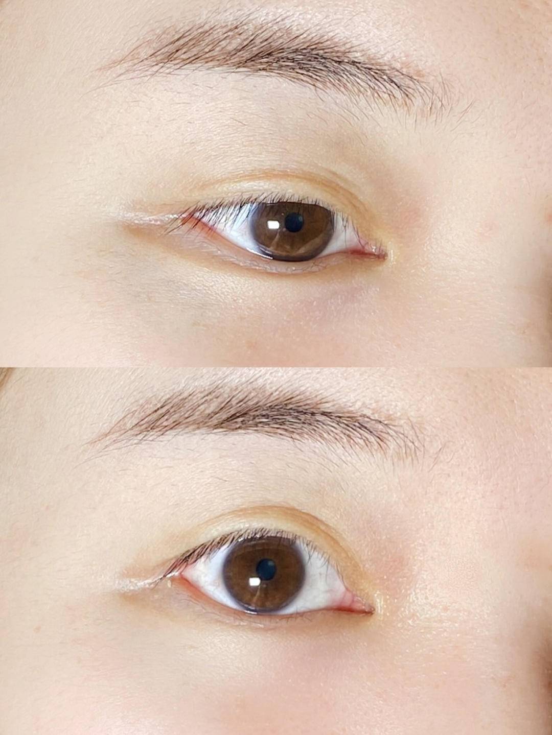 肌肤|十年如一日的真少女,我的抗老难题就这样被解决了