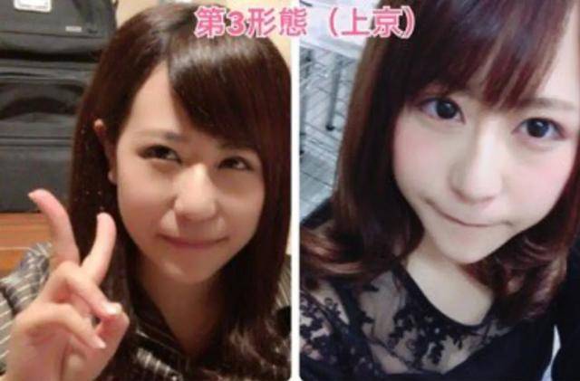 欺凌|长得丑被欺凌，日本妹子花400万成功“换头”，实现人生逆袭！