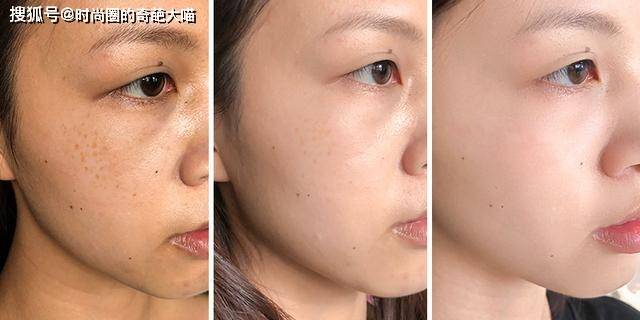 什么|李多海的脸遭遇了什么!坑坑洼洼粉都填不平,没了滤镜颜值太真实