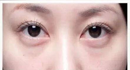 眼袋|从黑皮土妹变成CEO收割机，她到底do了什么？！