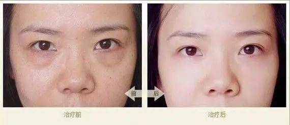 眼袋|从黑皮土妹变成CEO收割机，她到底do了什么？！