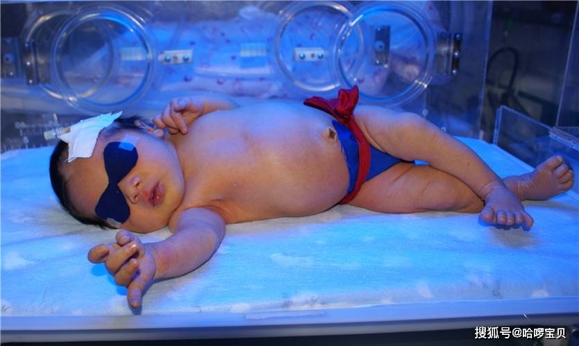 小黄人|没几天就变“小黄人”,是母乳质量不好吗?宝宝刚出生时粉嘟嘟