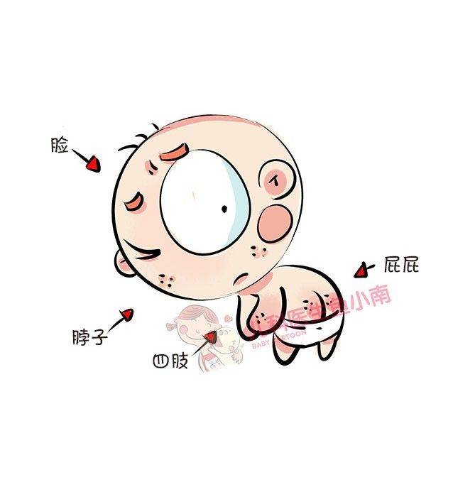 爸妈|此皮肤病秋季多发爸妈注意了