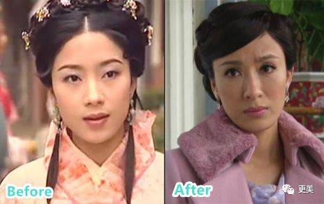 杨怡|曾经tvb一姐，演技一流，也把自己整僵了，假体太明显了...