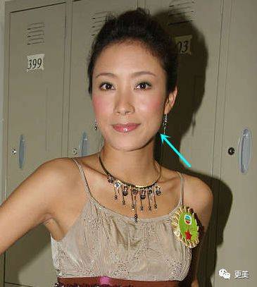 杨怡|曾经tvb一姐，演技一流，也把自己整僵了，假体太明显了...