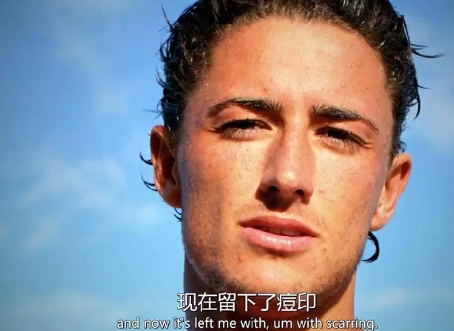 皮肤|16岁就上春晚的顶级流量，现在这脸怎么长残成这样了...