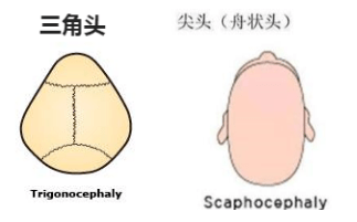 宝宝|你还没问宝宝乐不乐意呢巴巴的给宝宝睡成扁头