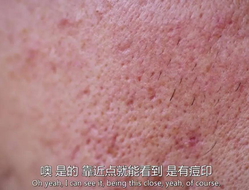 皮肤|16岁就上春晚的顶级流量，现在这脸怎么长残成这样了...