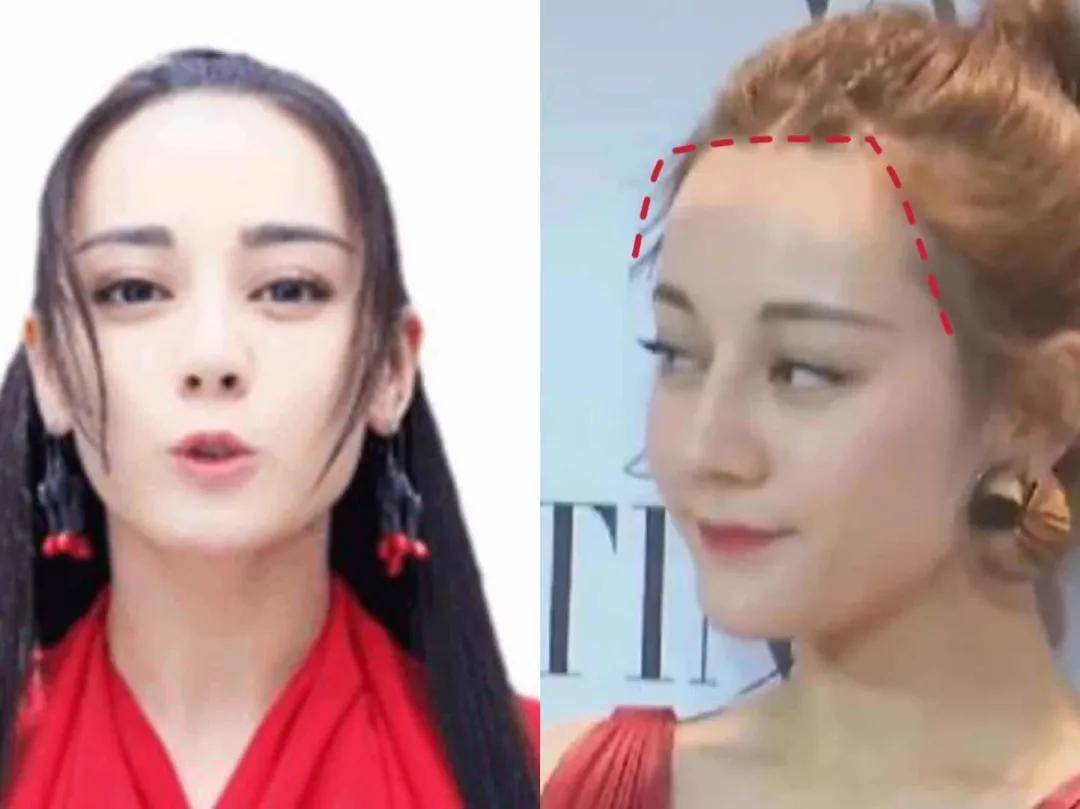 天花板|她颅顶低成洼地、还能美成内娱颜值天花板,高颅顶审美PUA何时结束?