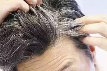 怎样快速长头发一天三厘米 6d058d6ecfdd4456b44e5799ef22c01c.jpeg