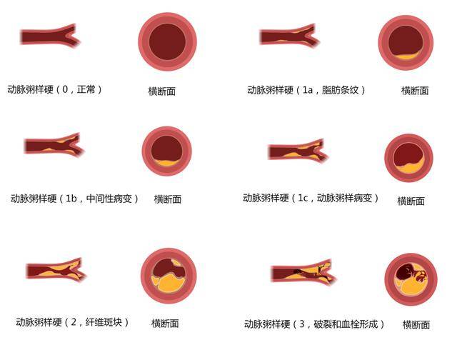 心血管系统高清矢量图汇总心内科医生必备