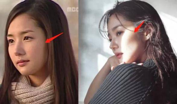 朴敏英|9年换5次头，do得毫无痕迹，双眼皮竟然还都是亲爸割的...