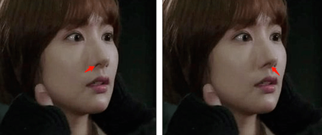 朴敏英|9年换5次头，do得毫无痕迹，双眼皮竟然还都是亲爸割的...