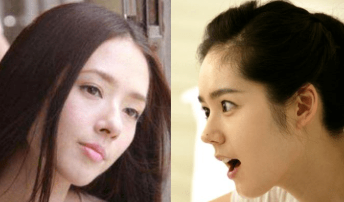 朴敏英|9年换5次头，do得毫无痕迹，双眼皮竟然还都是亲爸割的...