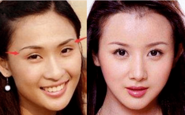 朴敏英|9年换5次头，do得毫无痕迹，双眼皮竟然还都是亲爸割的...