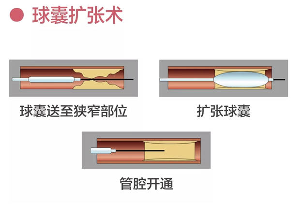 疾病|广安门医院举办“周围血管疾病义诊宣传日”系列活动