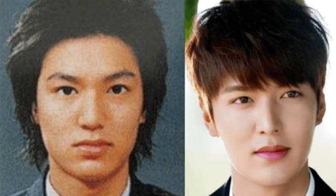 赵丽颖|鞠婧祎和赵丽颖竟然是同一个医生？