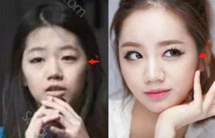 李惠利|女明星最绝大鼻头变身记！娜扎do鼻子前应该找她取经1000次...