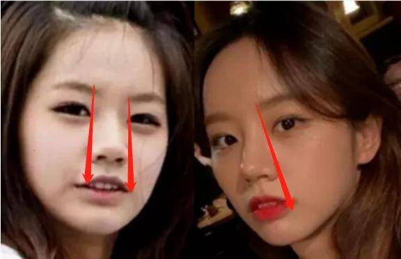 李惠利|女明星最绝大鼻头变身记！娜扎do鼻子前应该找她取经1000次...