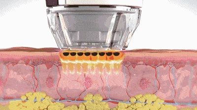 毛孔|权志龙，你真的不能再整了啊...