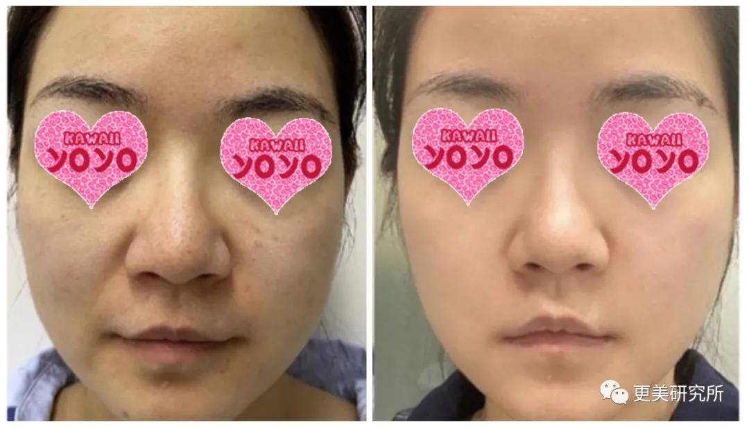 任天王|隐忍10年两任天王嫂杠上热搜！各自成家这么久，怎么还在较劲